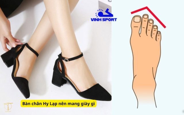 Bàn chân Hy Lạp nên mang giày gì